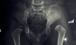 小孩检查屁股视频,育儿专家教你如何正确观察宝宝健康